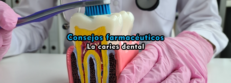 Consejos farmacéuticos: la caries dental