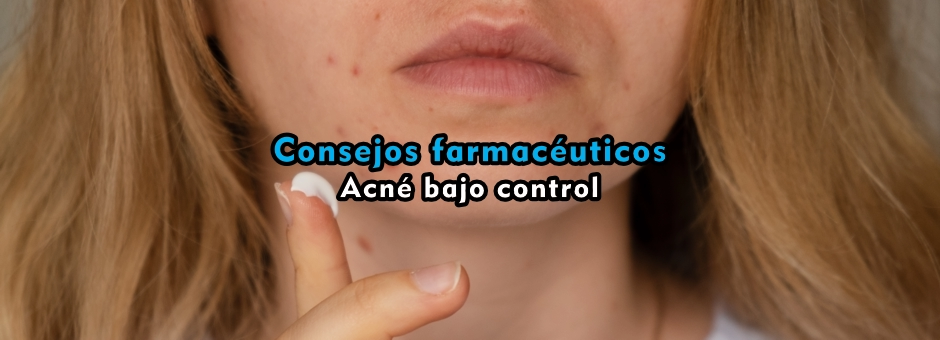 Consejos farmacéuticos: acné bajo control