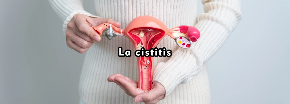 La cistitis