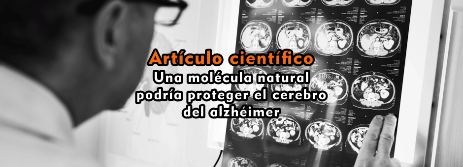 Una molécula natural podría proteger el cerebro del alzhéimer