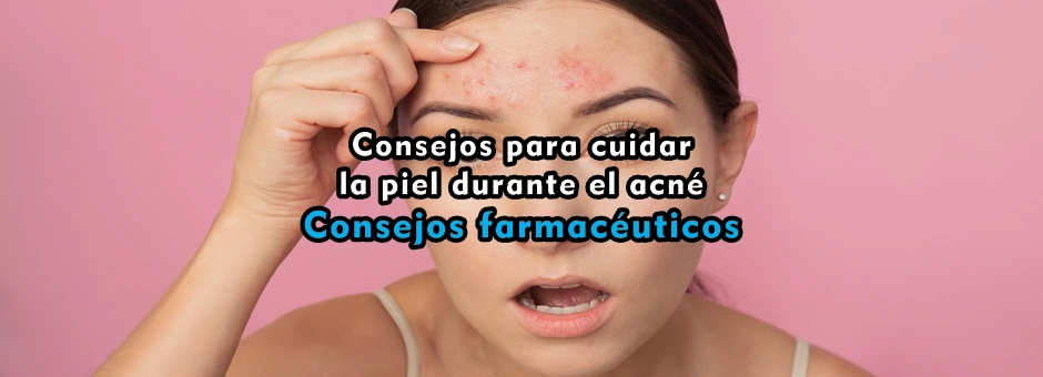 Consejos para cuidar la piel durante el acné