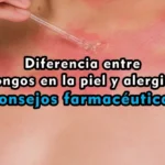 Diferencia entre hongos en la piel y alergias